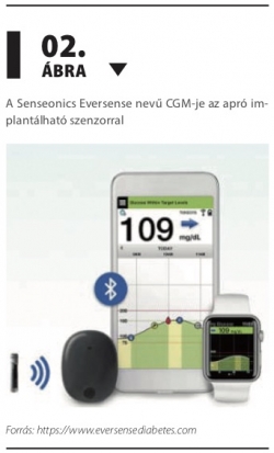 A Senseonics Eversense nevű CGM-je az apró implan tálható szenzorral