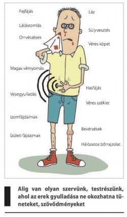 Az érgyulladás (vasculitis) típusai