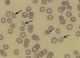1. ábra. Vérkenet fragmentocitákkal – a nyilak néhány jellegzetes sejttöredéket jelölnek. Trombociták egyáltalán nem láthatók