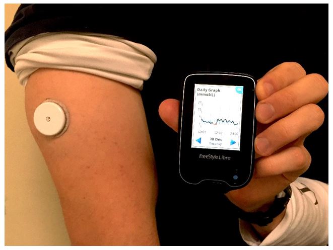 Szúrás nélkül, saját mobiljával is ellenőrizheti vércukorszintjét - EgészségKalauz
